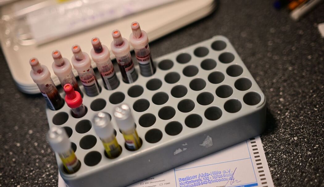 HIV-Test