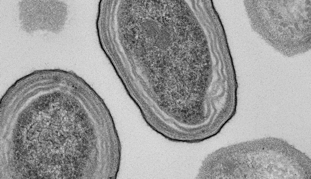 Prochlorococcus-Zellen