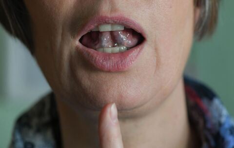 Die wichtigsten Fragen und Antworten zum Welttag des Stotterns