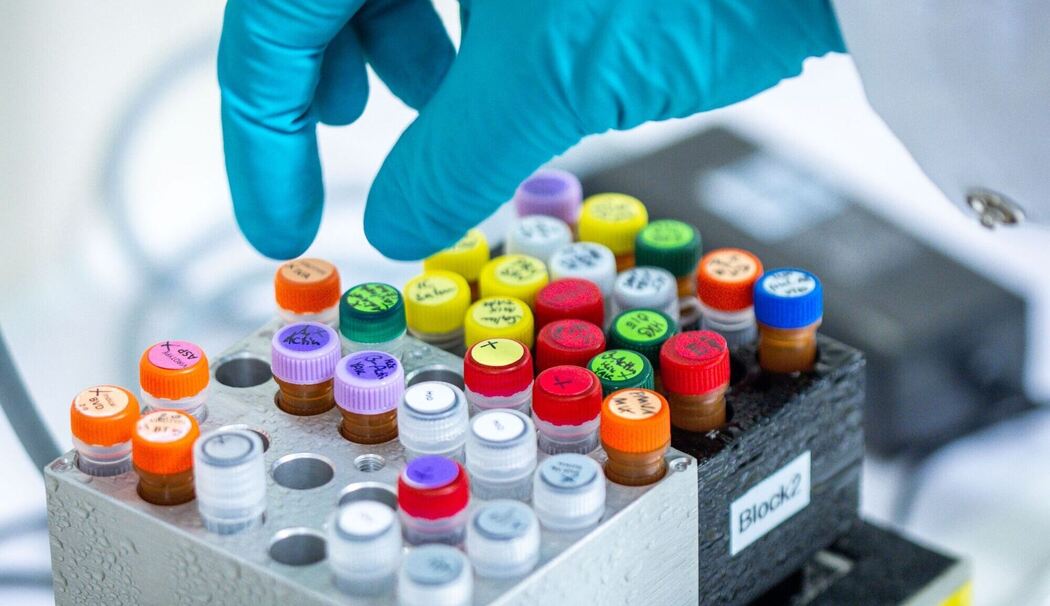 Zwei Menschen an Ehec gestorben Zwei Menschen an Ehec gestorben