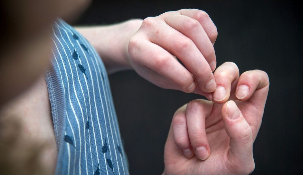 Eine Frau knibbelt an ihren Fingernägeln Eine Frau knibbelt an ihren Fingernägeln