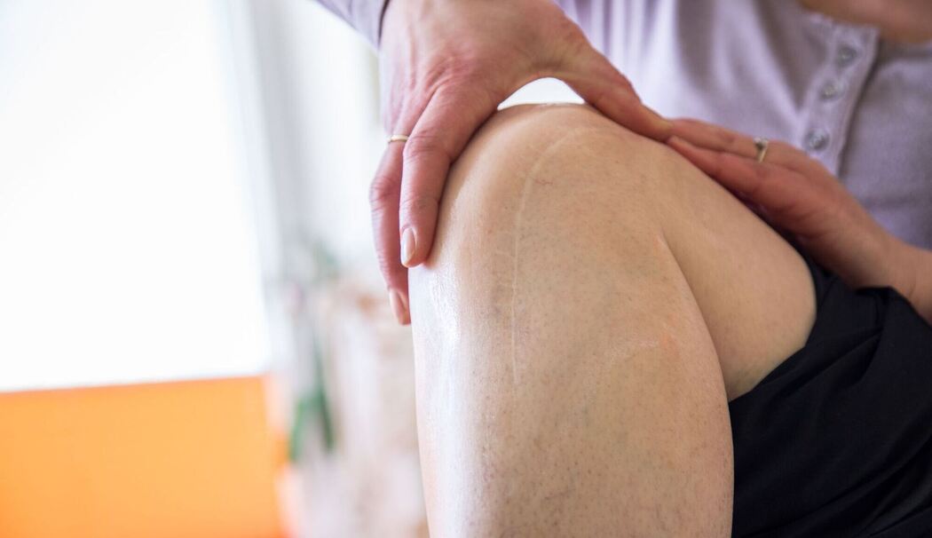 Eine Frau massiert eine Operationsnarbe am Knie Eine Frau massiert eine Operationsnarbe am Knie
