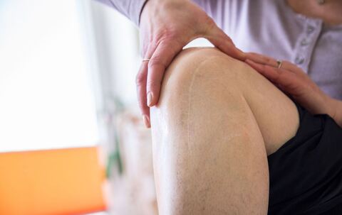 Eine Frau massiert eine Operationsnarbe am Knie