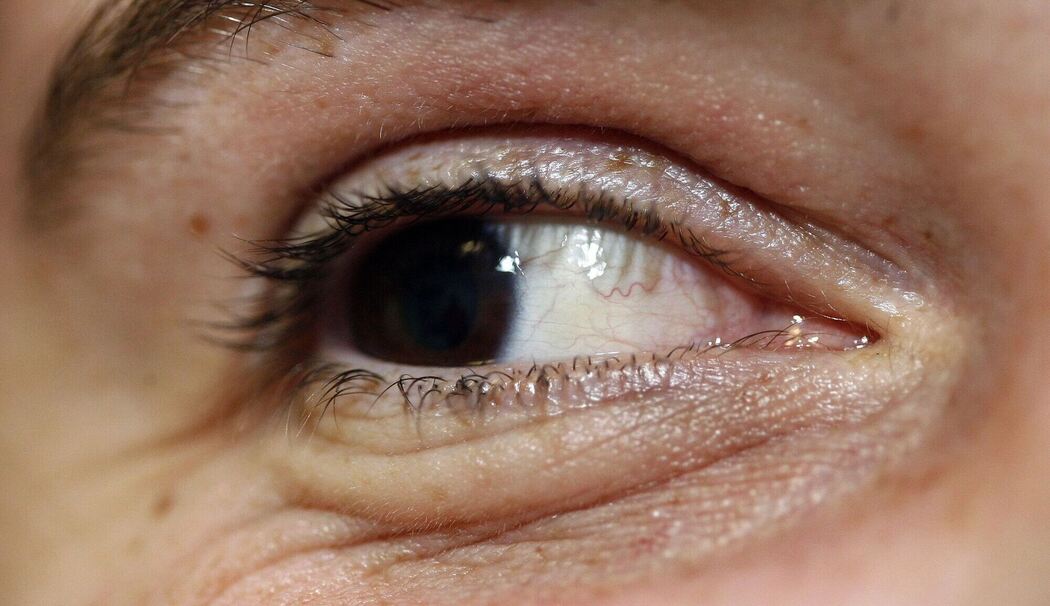 Warum Menschen beim Musikhören im Takt blinzeln Warum Menschen beim Musikhören im Takt blinzeln