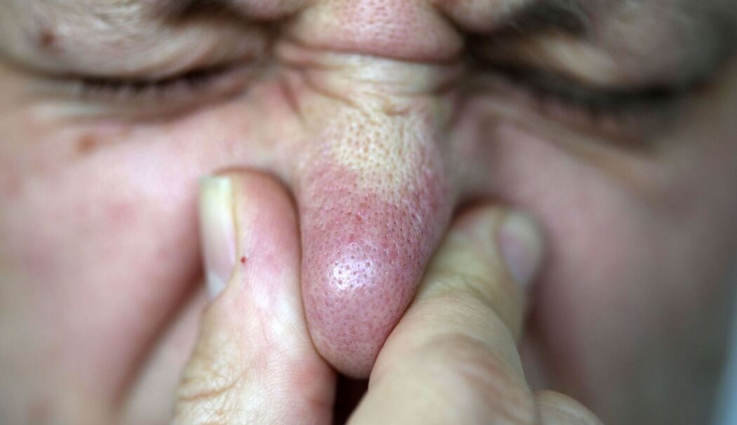 Gestank in Karlstein