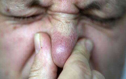 Gestank in Karlstein 